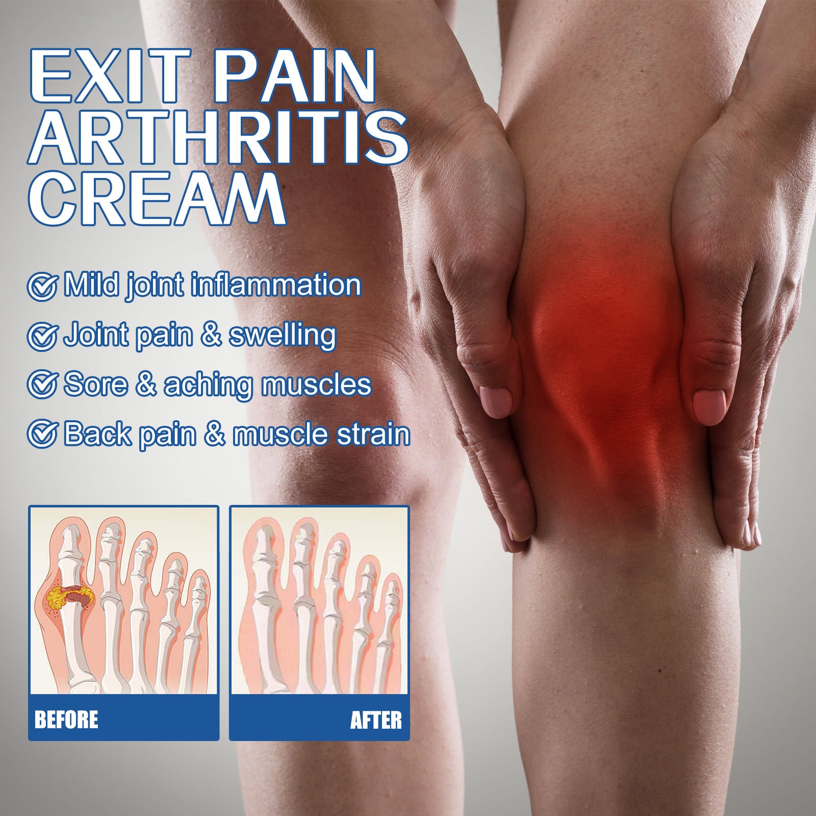 Arthritis Joint Pain Relief Cream