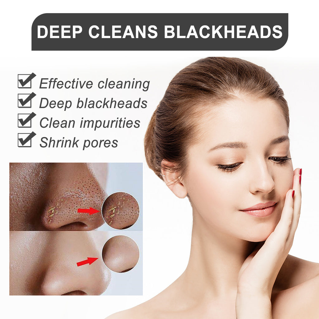Blackhead-clearing Cream