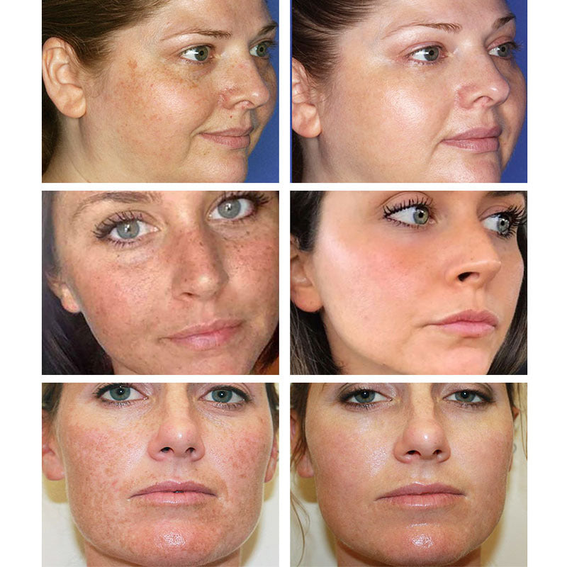Dark Spot and Pore Shrinking Cream