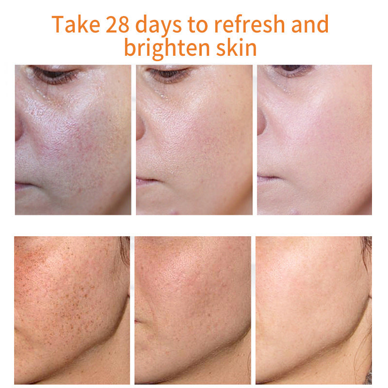 Dark Spot and Pore Shrinking Cream