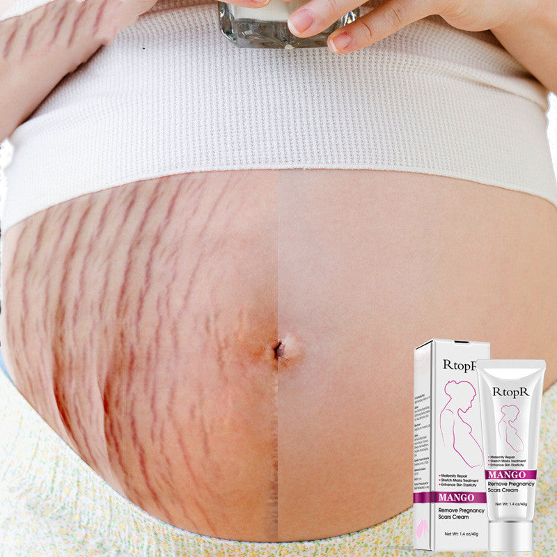 Mango Pregnancy Scar Cream