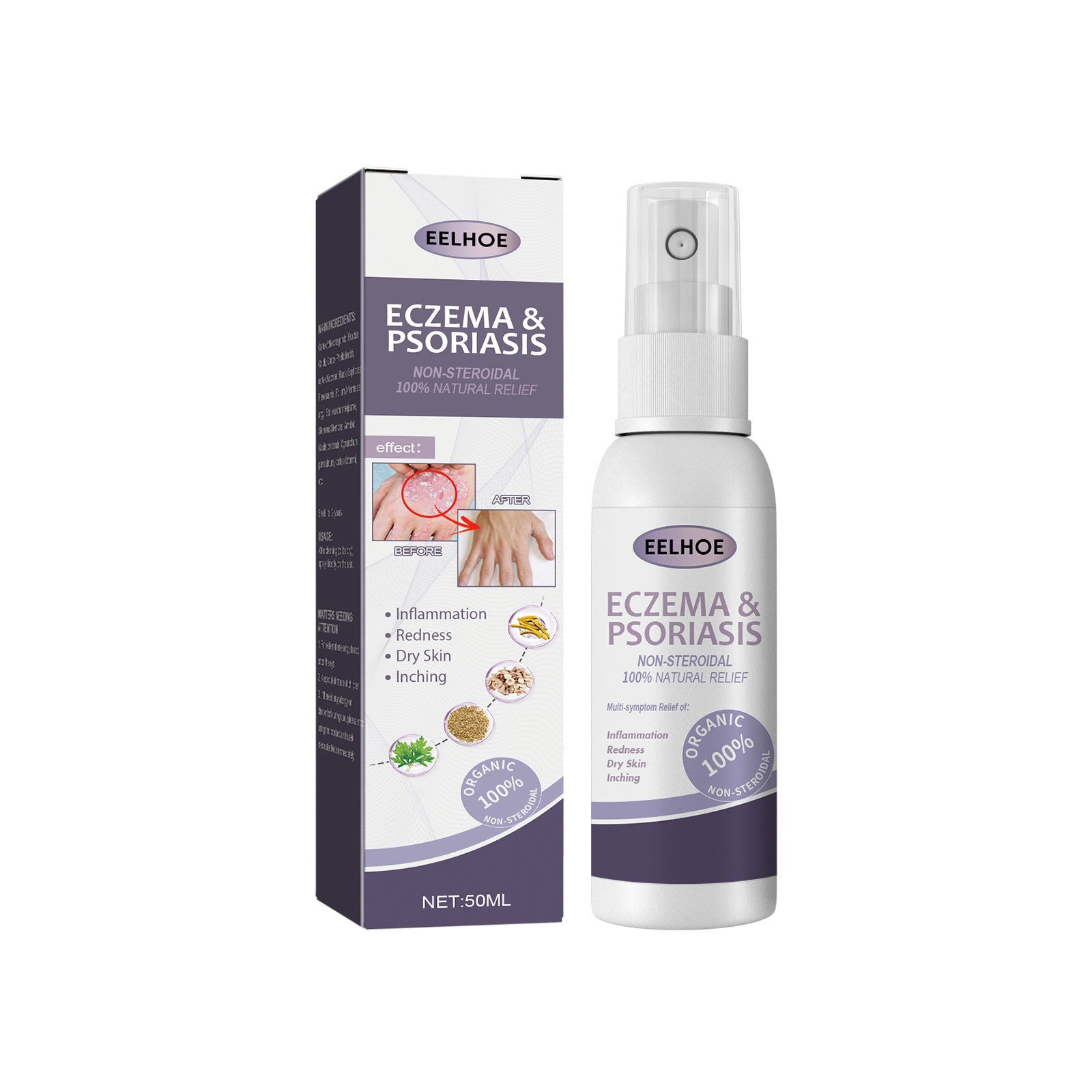 Psoriasis Itching Relief Spray