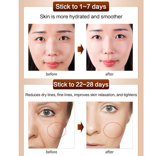 Anti-Wrinkle Cream