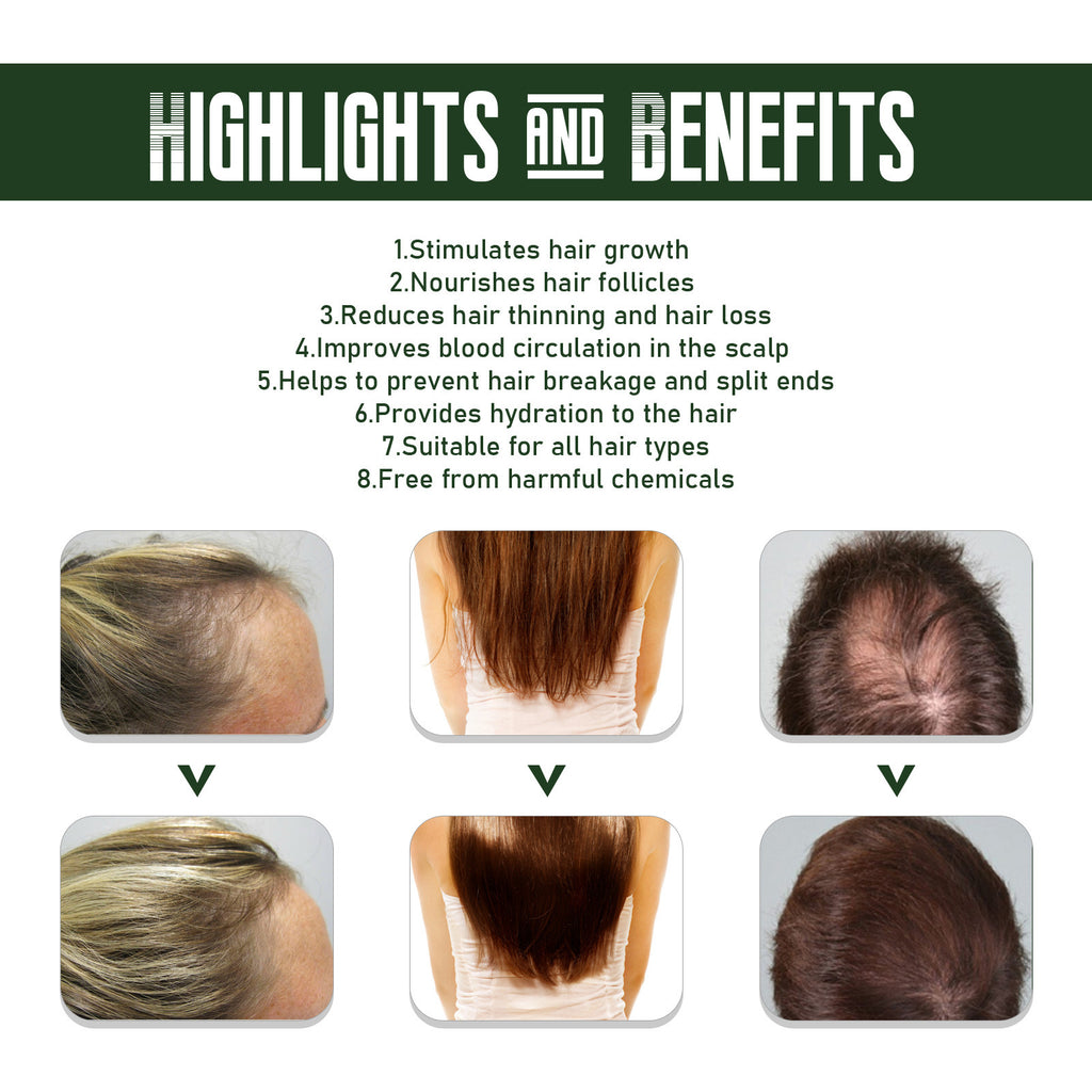 Ginger Hair Spray Anti-Hair Loss