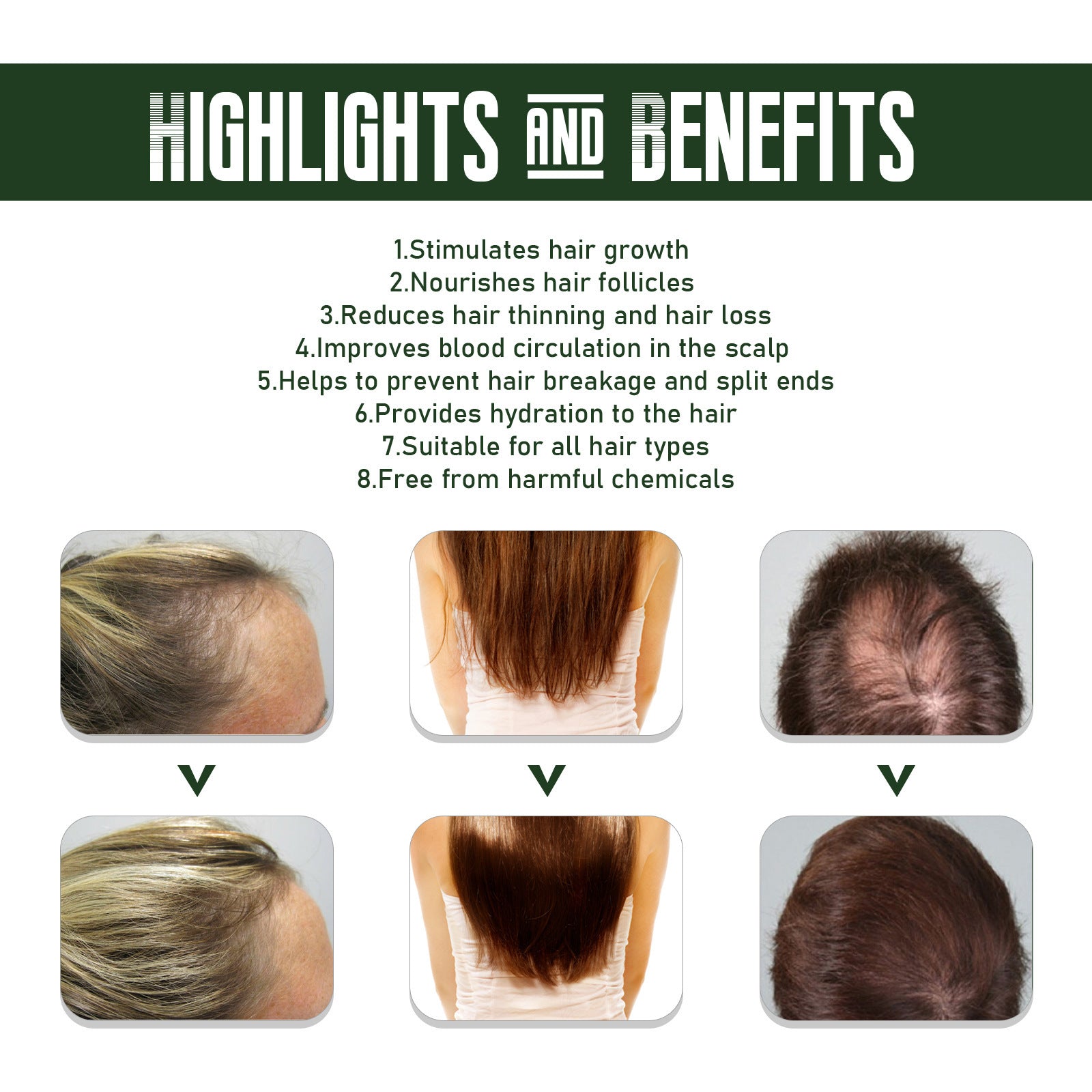 Ginger Hair Spray Anti-Hair Loss