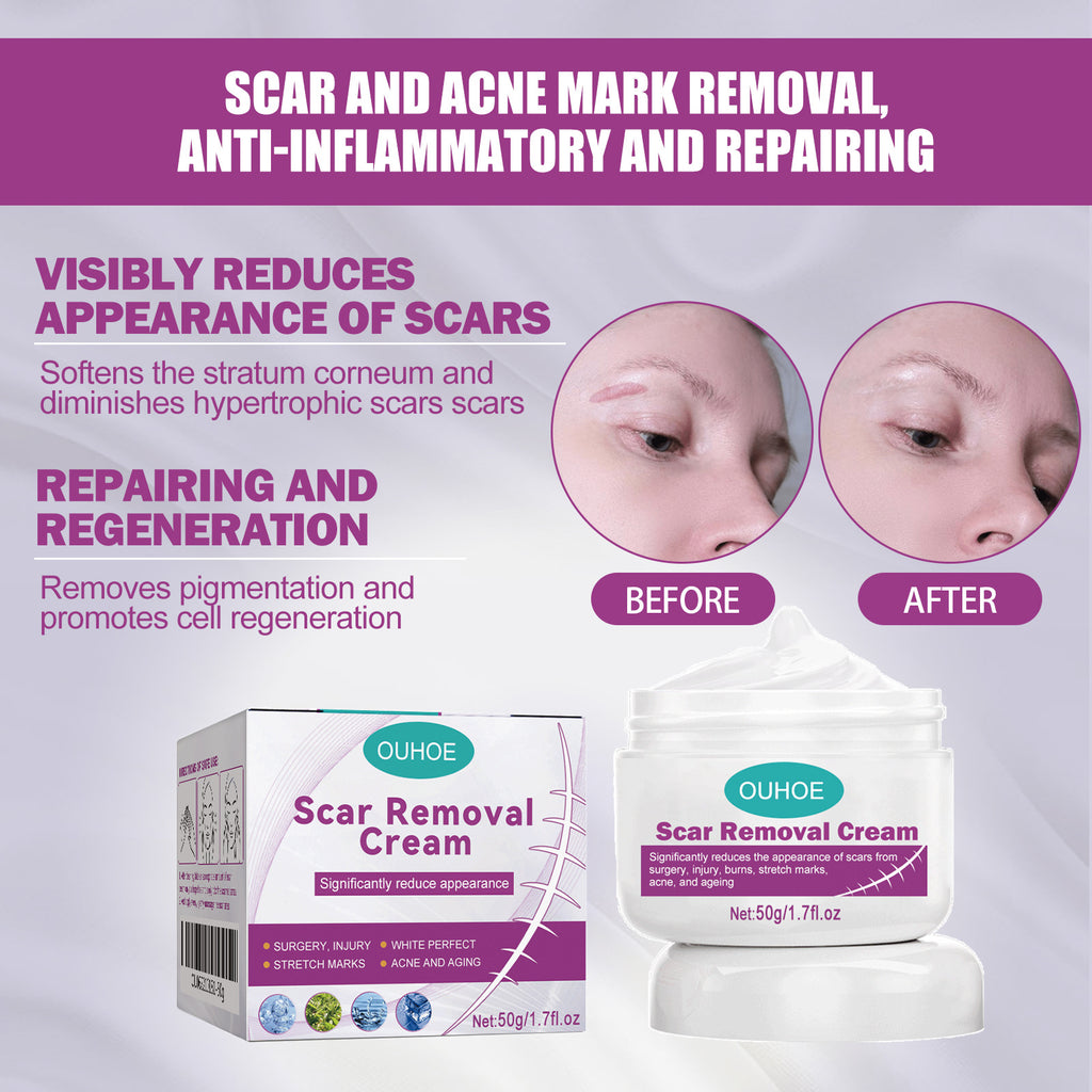 Scar Fading Skin Cream