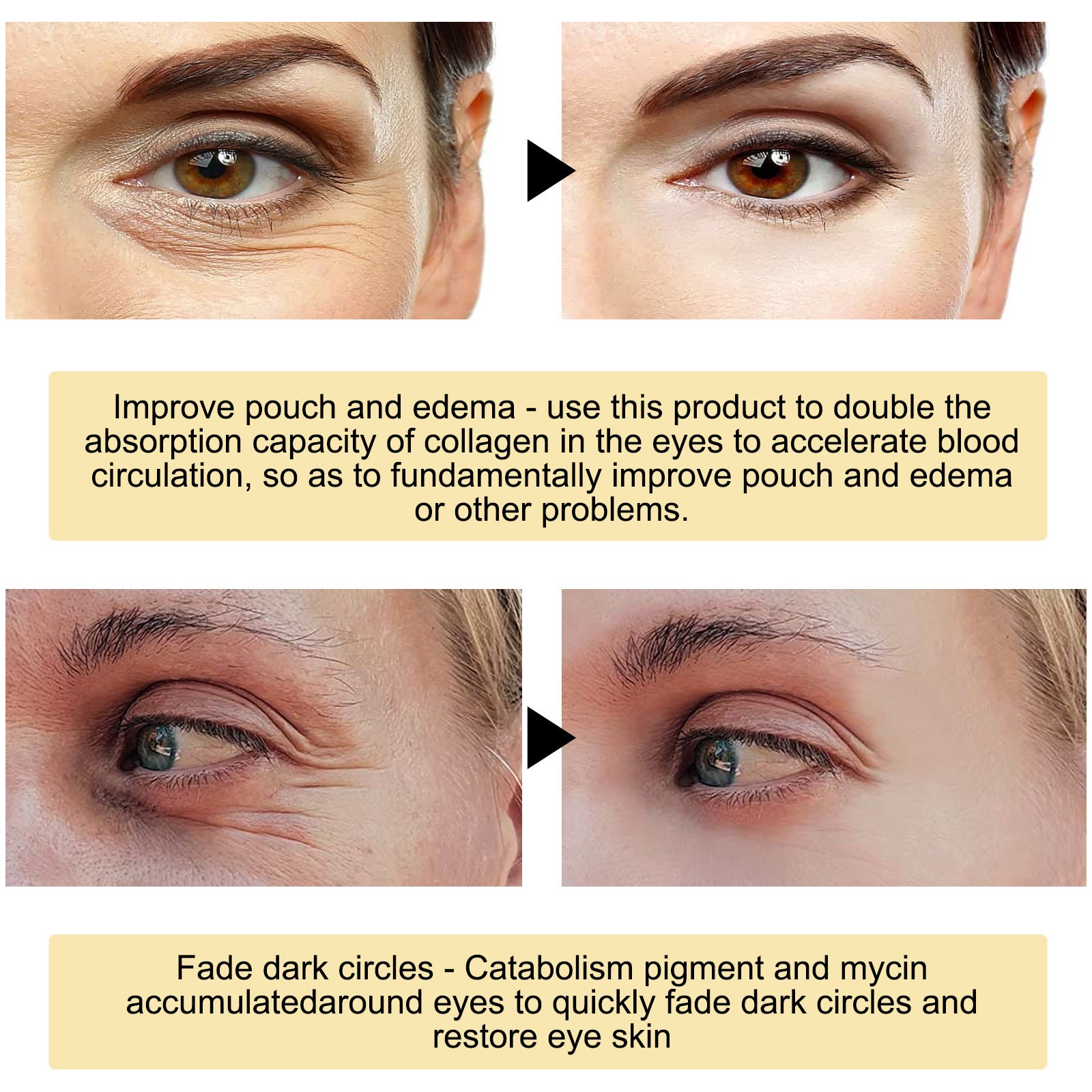 Eye Bags And Hydrating Moisturizing Mask