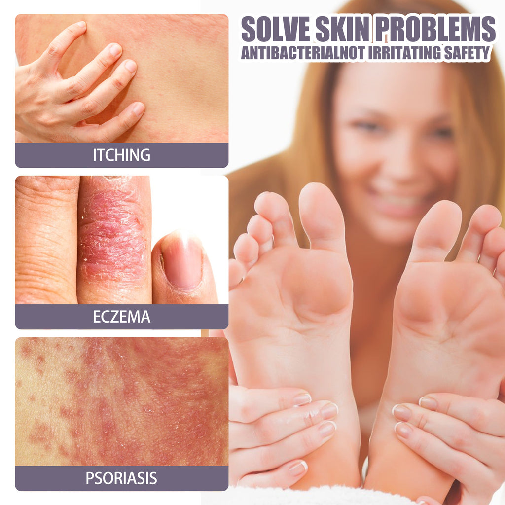 Psoriasis Itching Relief Spray