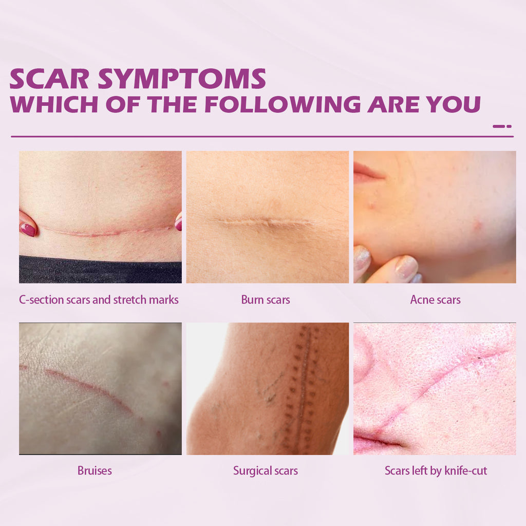 Scar Fading Skin Cream