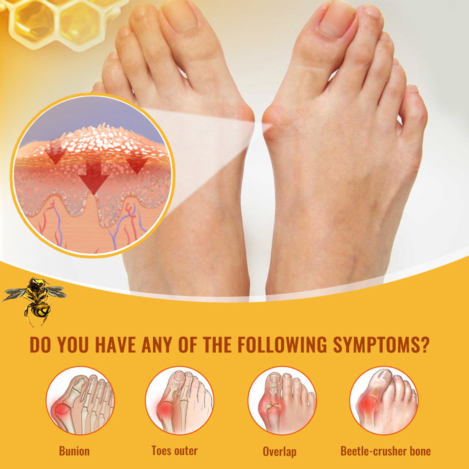 Joint Muscle And Knee Pain Balm
