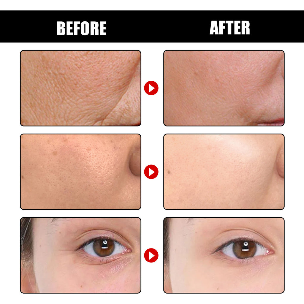 Anti Aging Serum