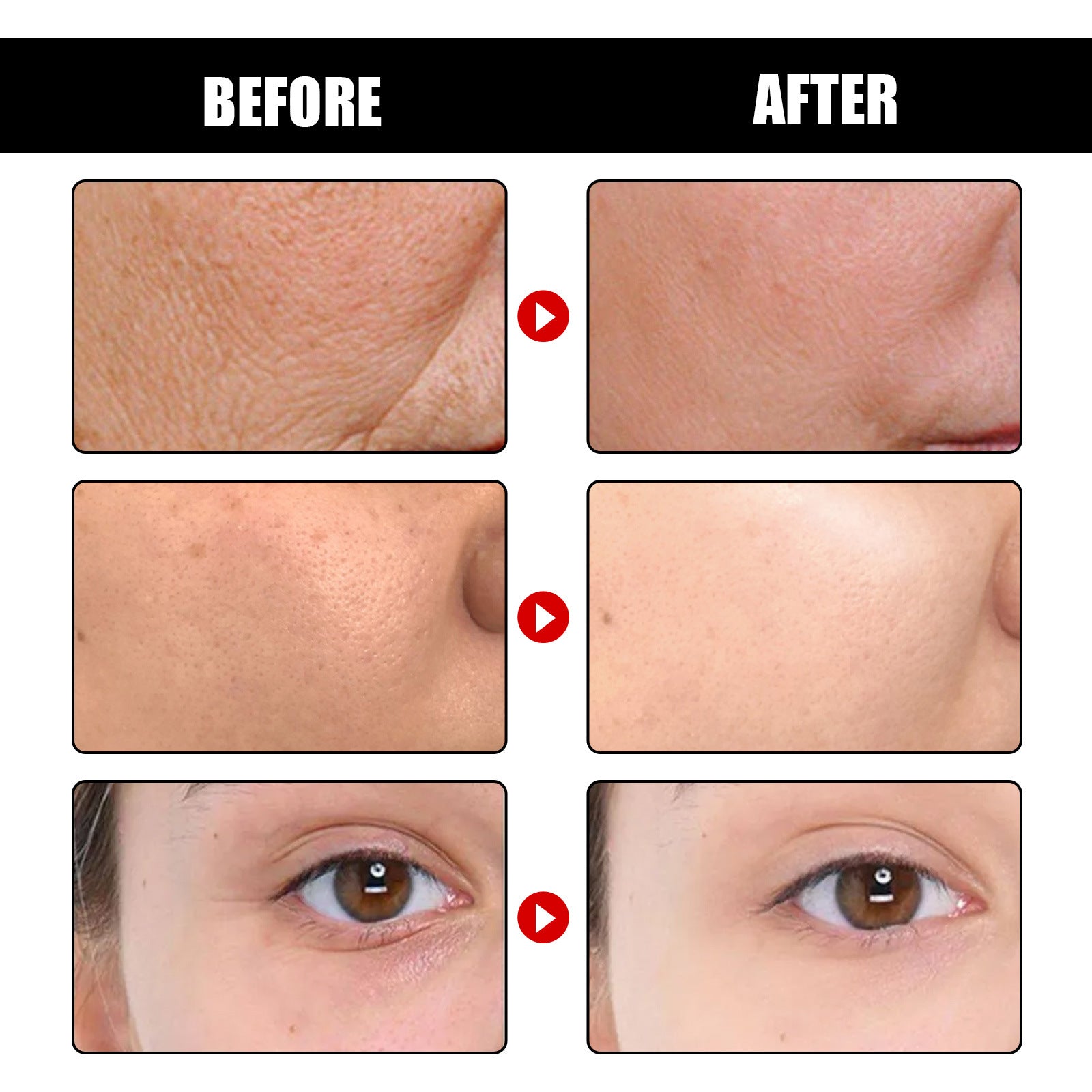 Anti Aging Serum