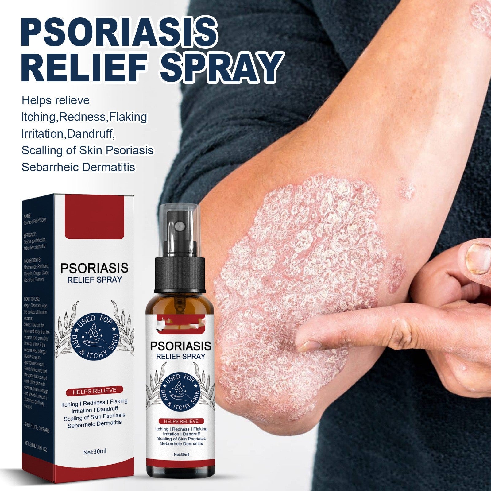 Psoriasis Soothing Spray
