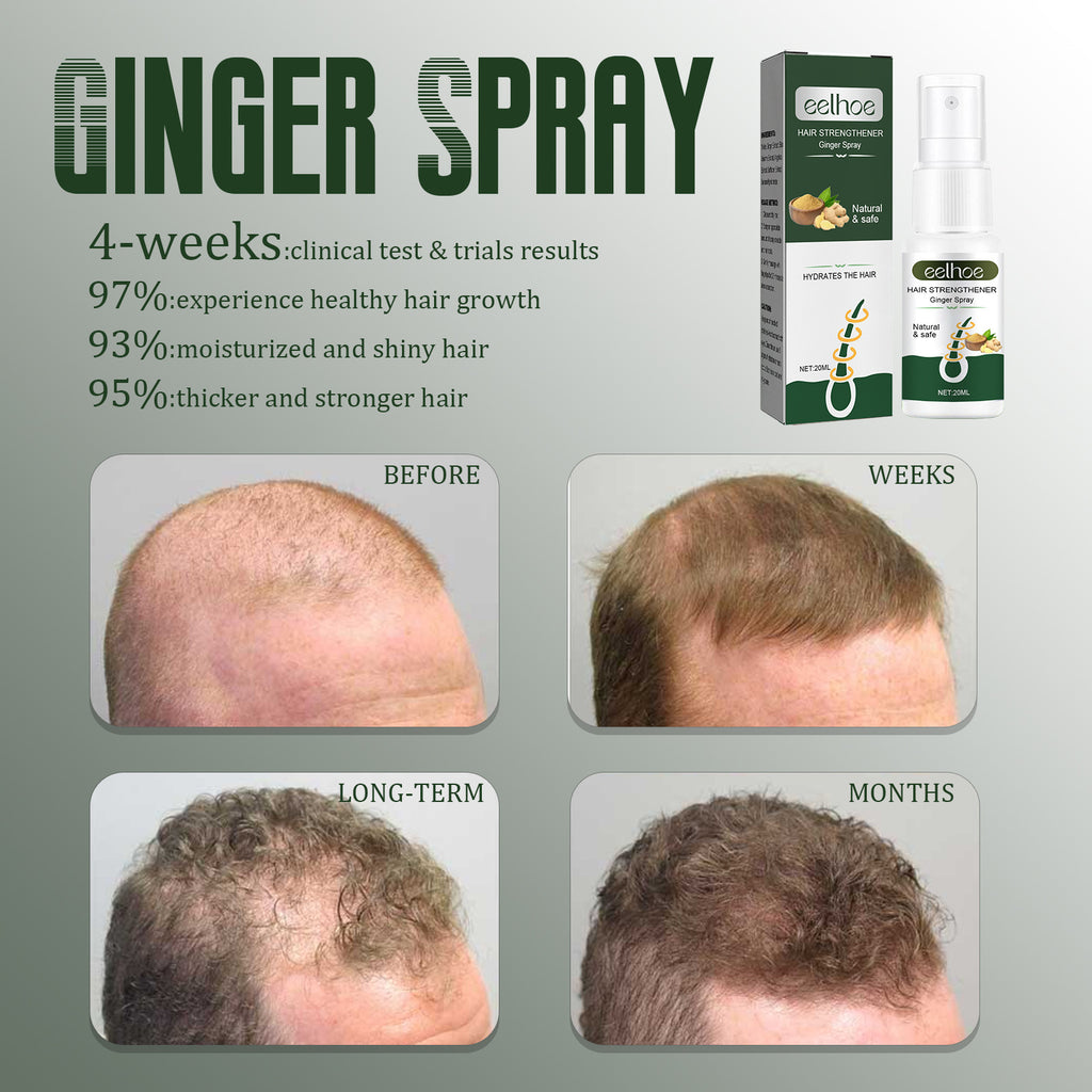 Ginger Hair Spray Anti-Hair Loss