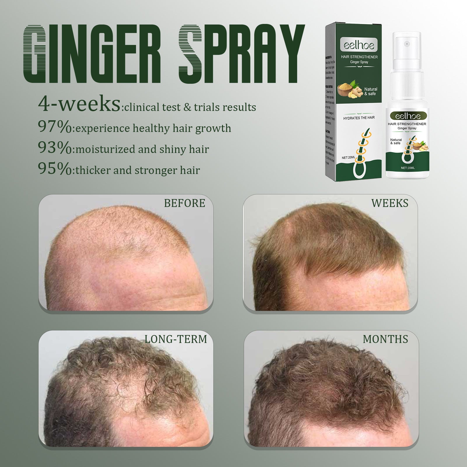 Ginger Hair Spray Anti-Hair Loss