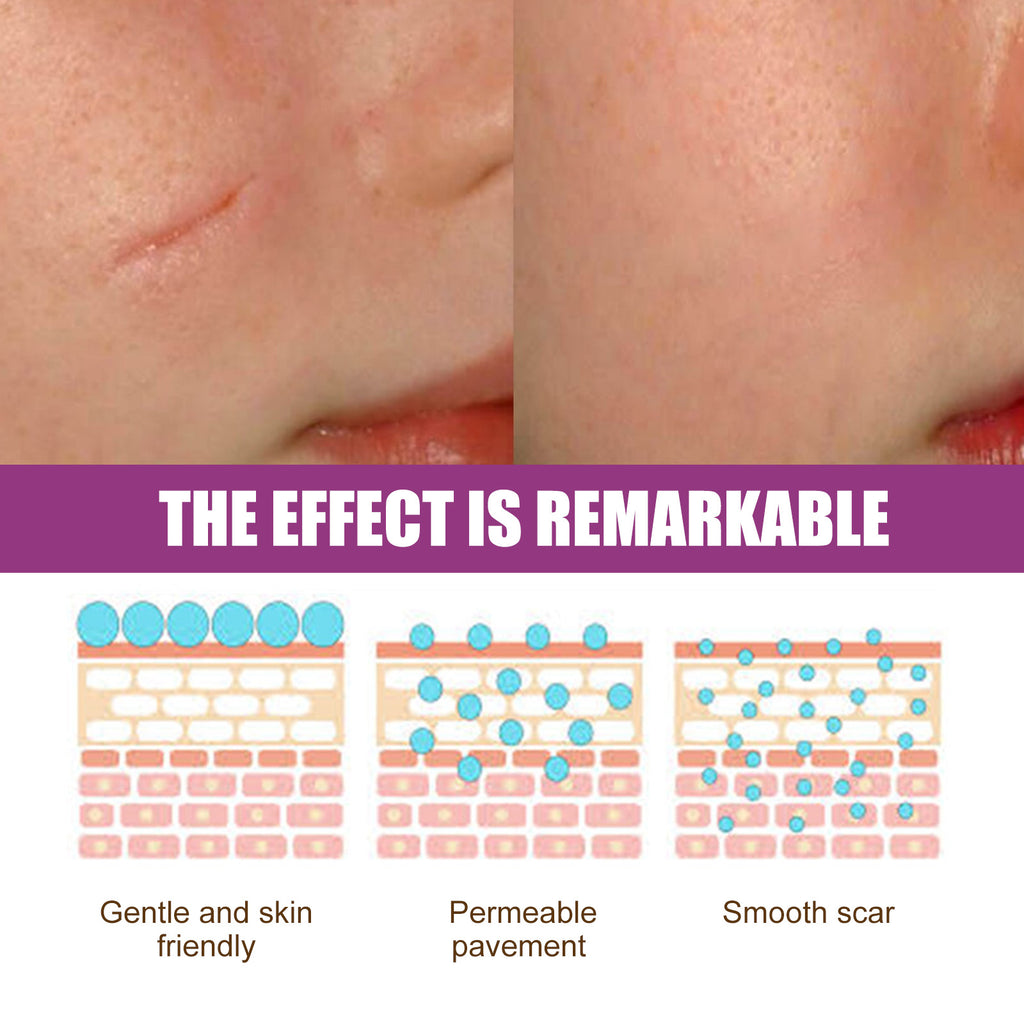 Scar Fading Skin Cream