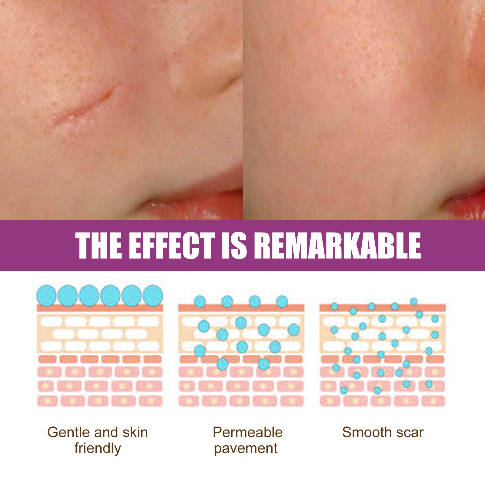 Scar Fading Skin Cream
