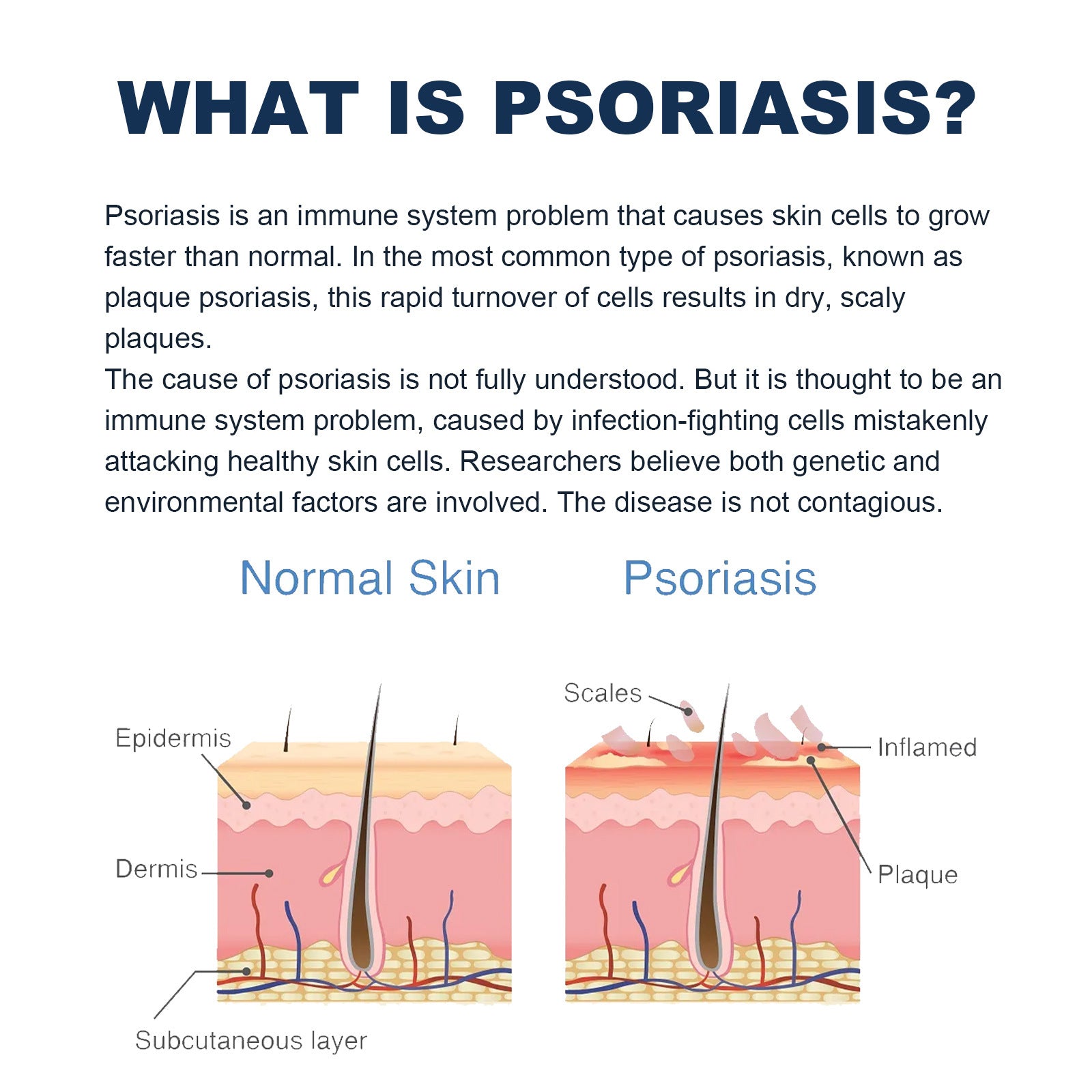 Psoriasis Soothing Spray