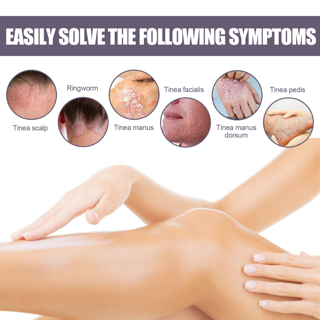 Psoriasis Itching Relief Spray