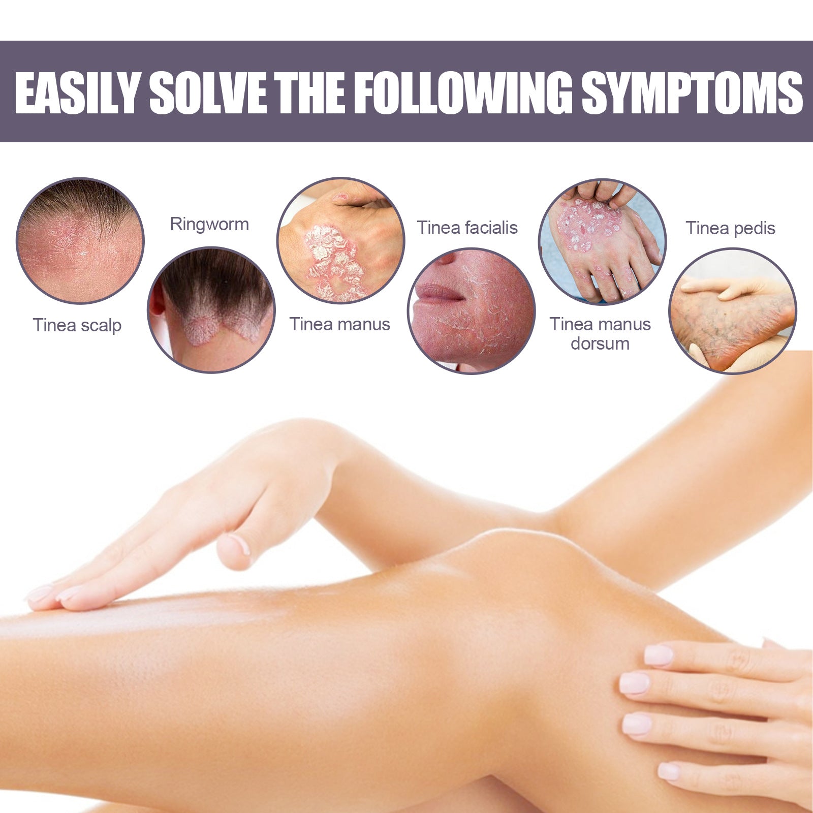 Psoriasis Itching Relief Spray