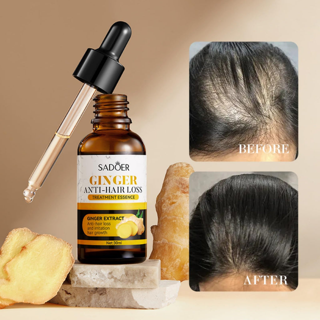 Ginger Hair Loss Oil