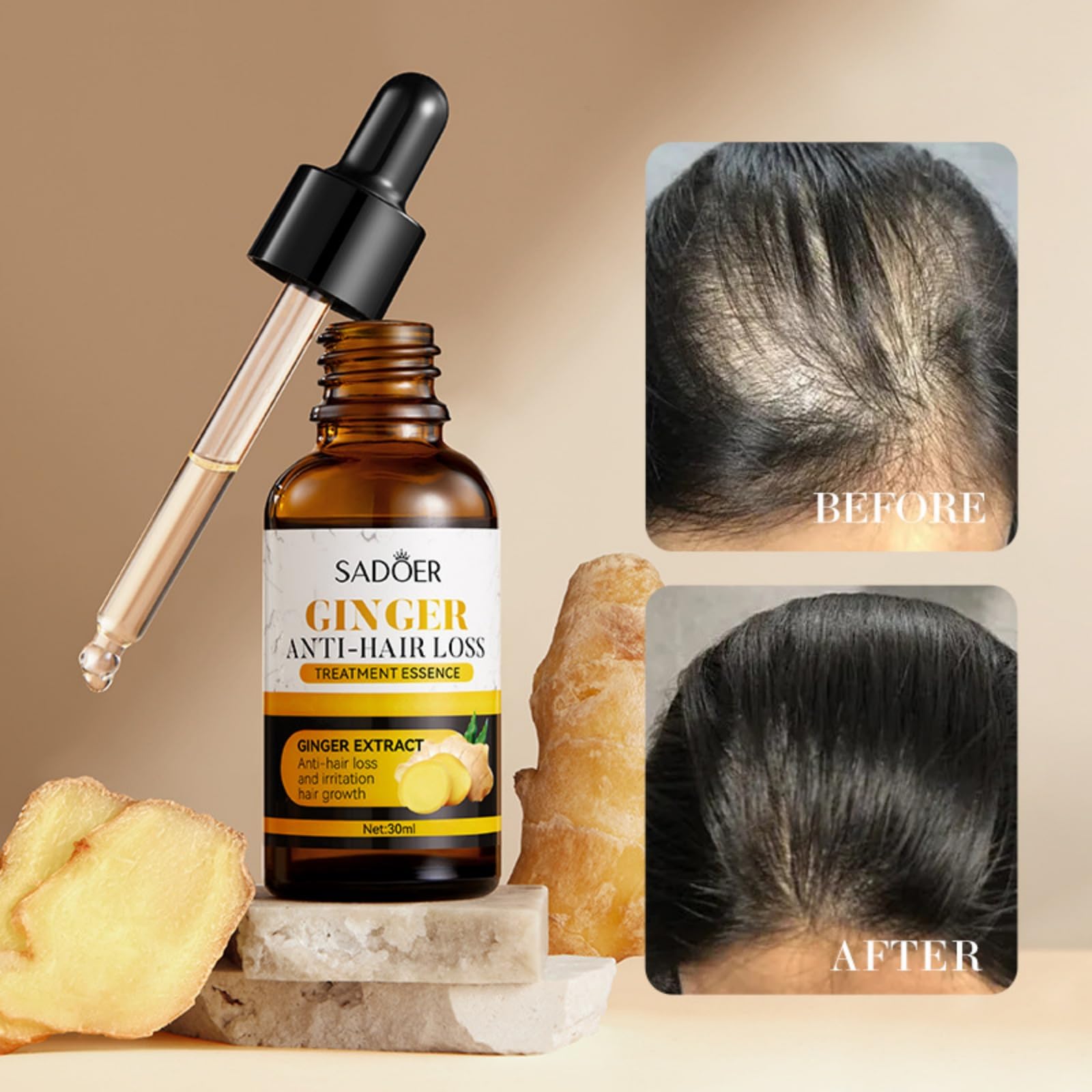 Ginger Hair Loss Oil