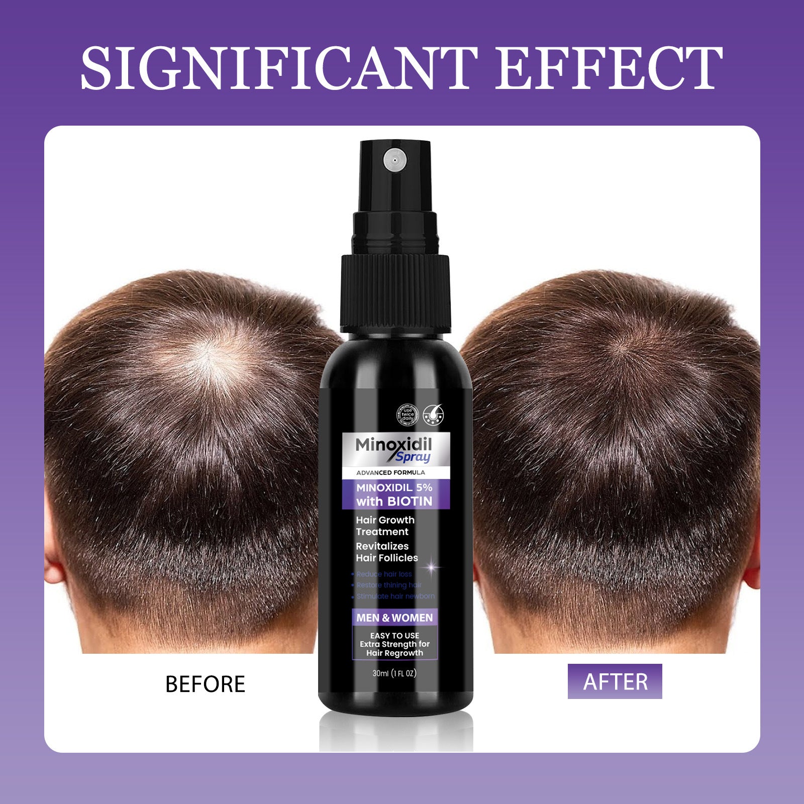 Minoxidil Hair Care Spray