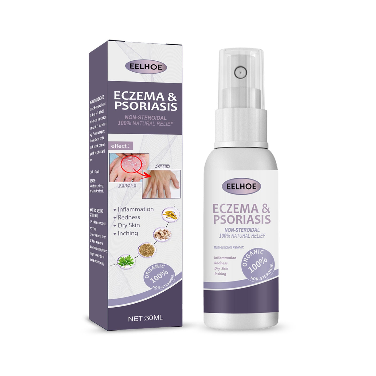 Psoriasis Itching Relief Spray