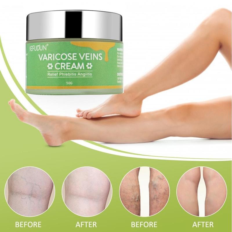 Varicose Vein Cream
